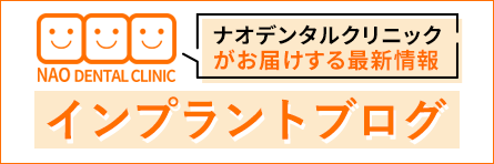 ナオデンタルクリニックがお届けする最新情報 インプラントブログ