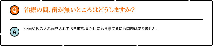 治療の間、歯が無いところはどうしますか？ 仮歯や仮の入れ歯を入れておきます。見た目にも食事するにも問題はありません。