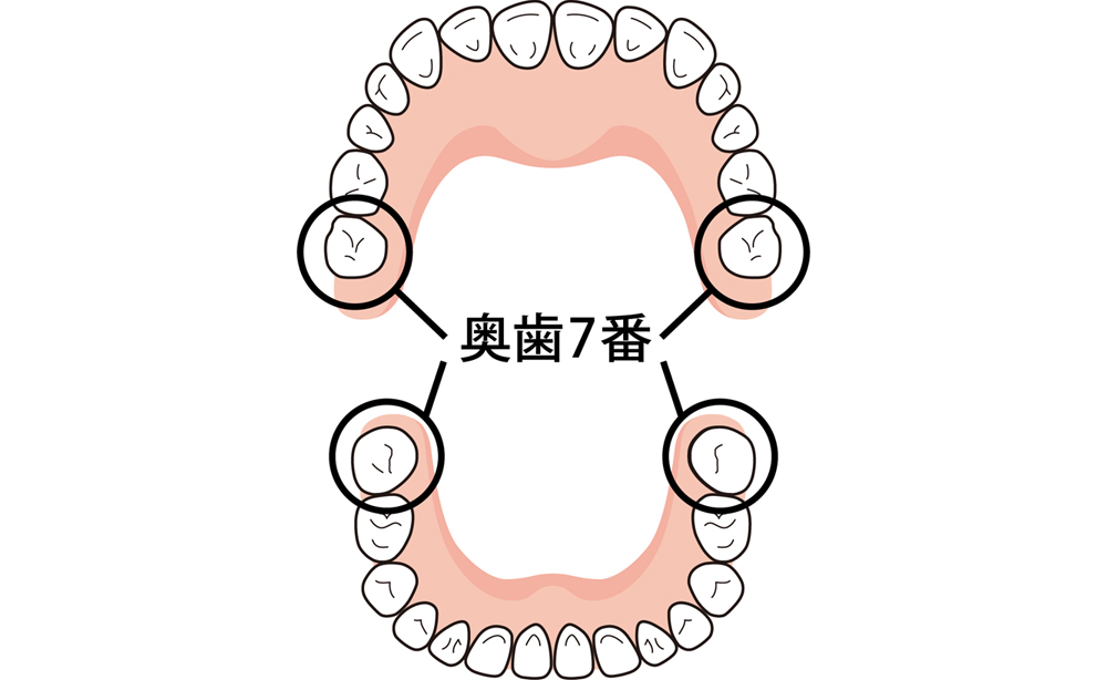 奥歯7番