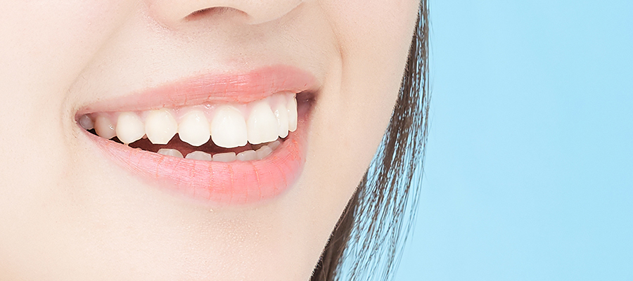 歯並びや白さをセラミック治療によって改善する