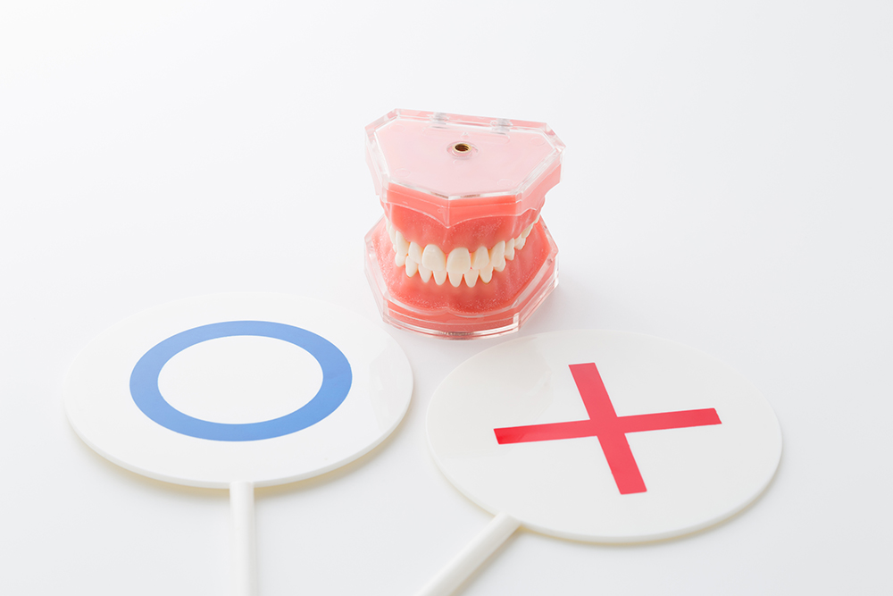 自費に繋がるインプラントオーバーデンチャー | DentalMovie