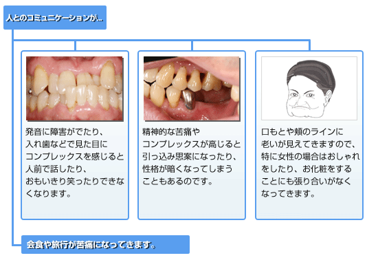 奥歯を失うと起こる障害2